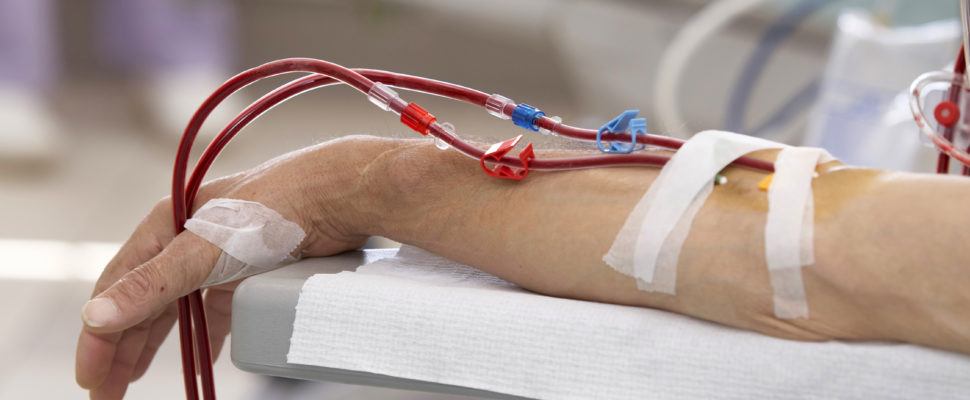 haemodialysis medicine