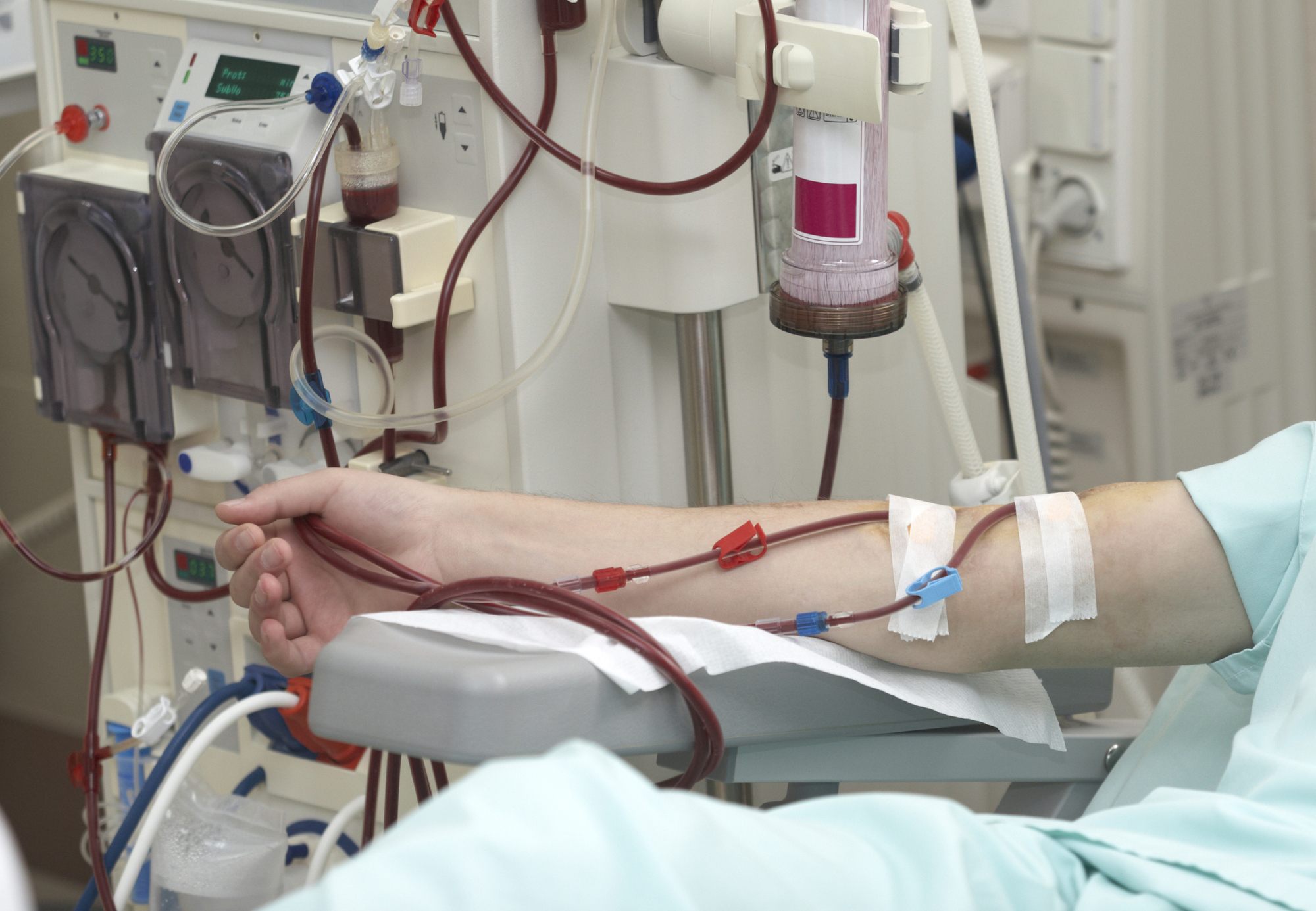 dialysis health care medicine kidney