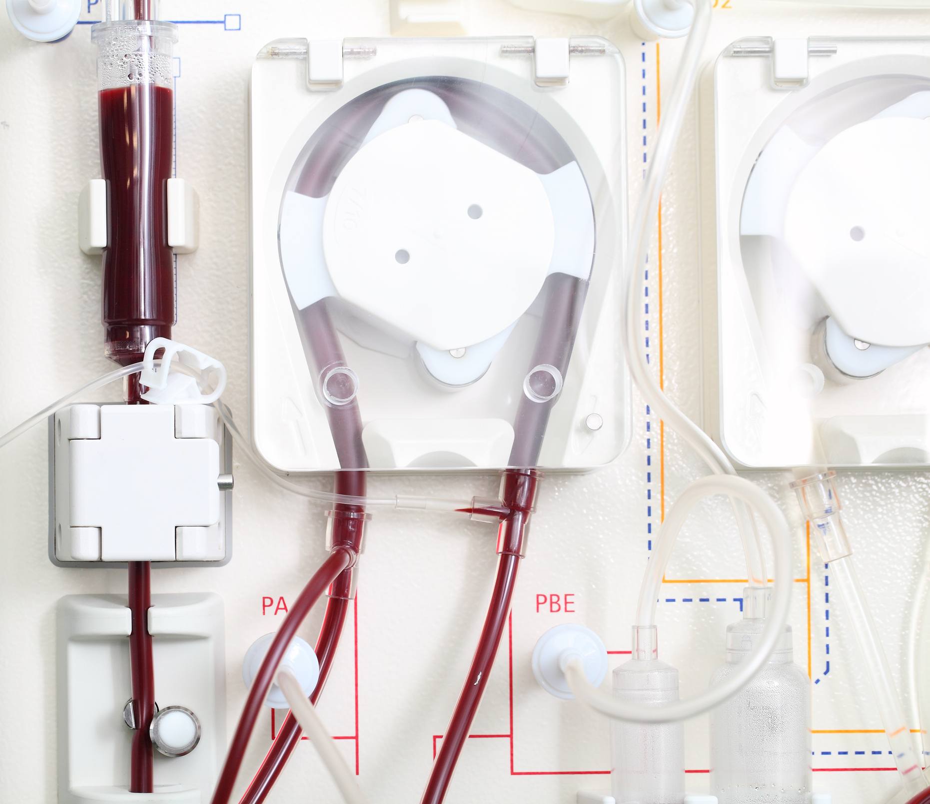 hemodialysis machine close-up