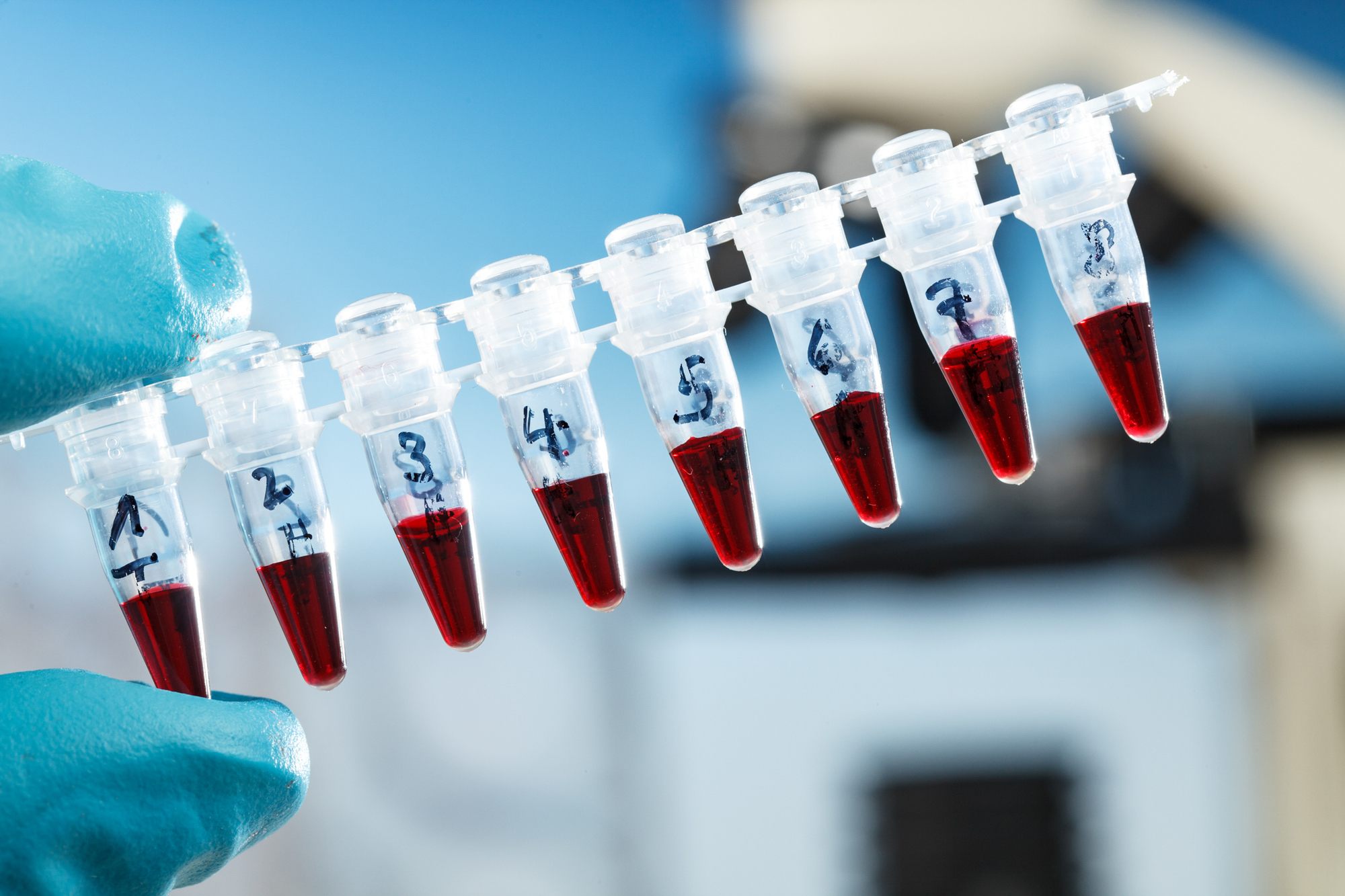 PCR items in laboratory